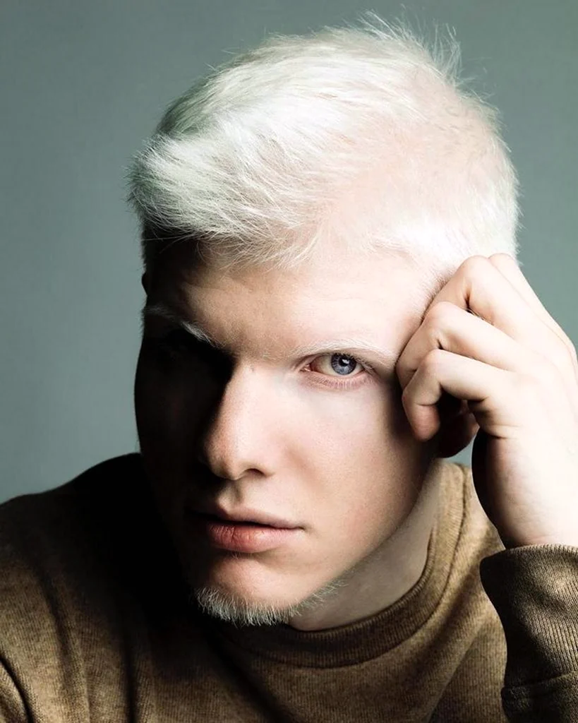 Иванишвили альбинос