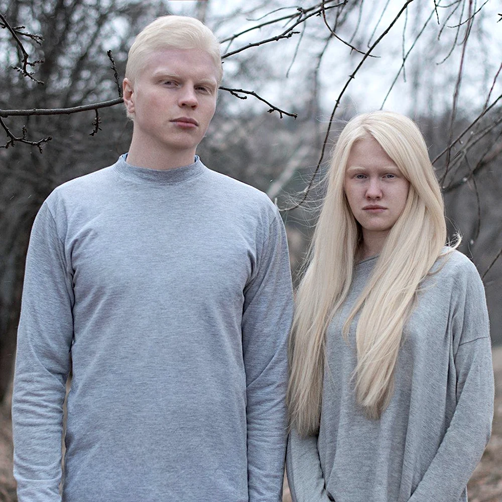 Пара альбиносов