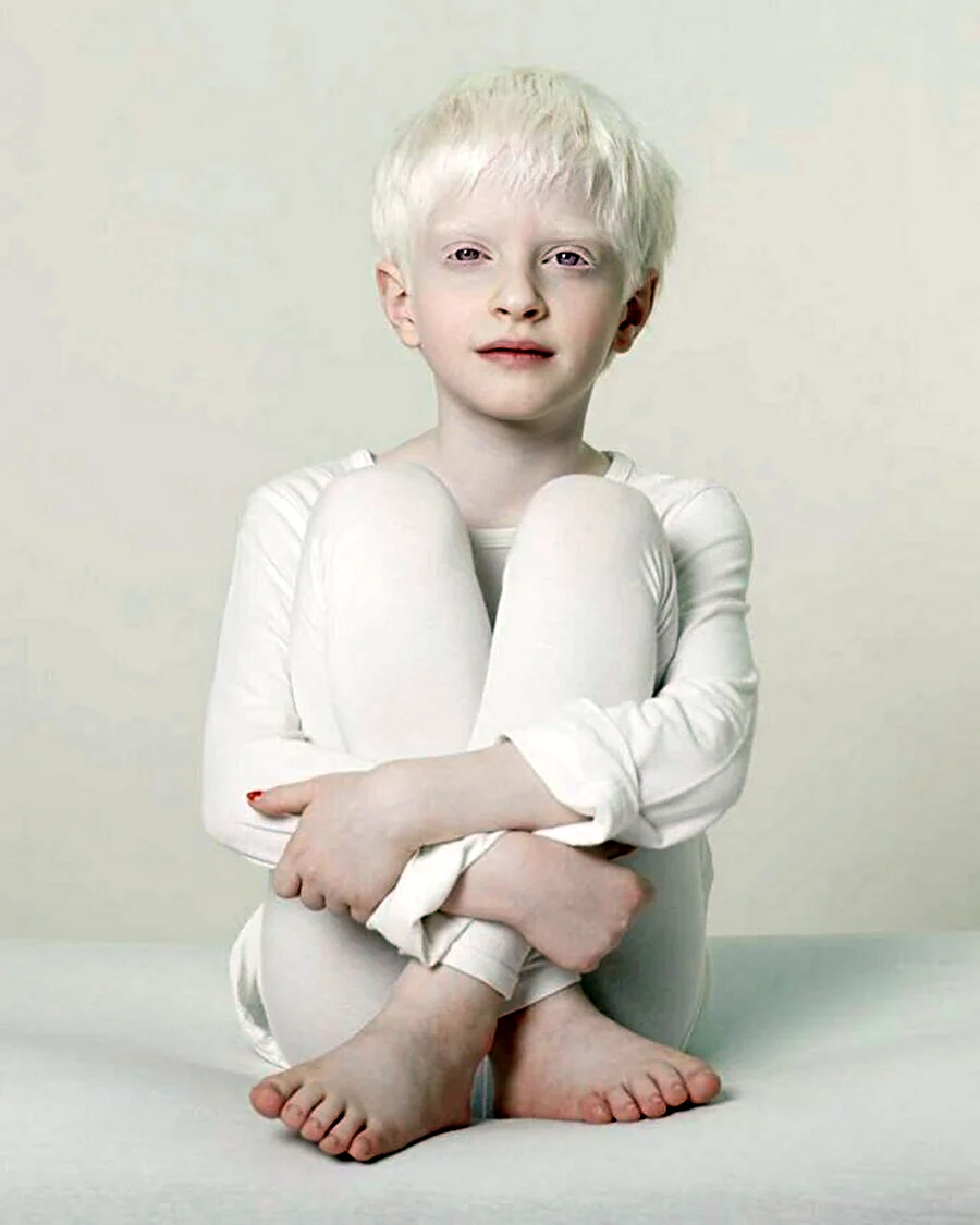 Саша Смирнов альбинос