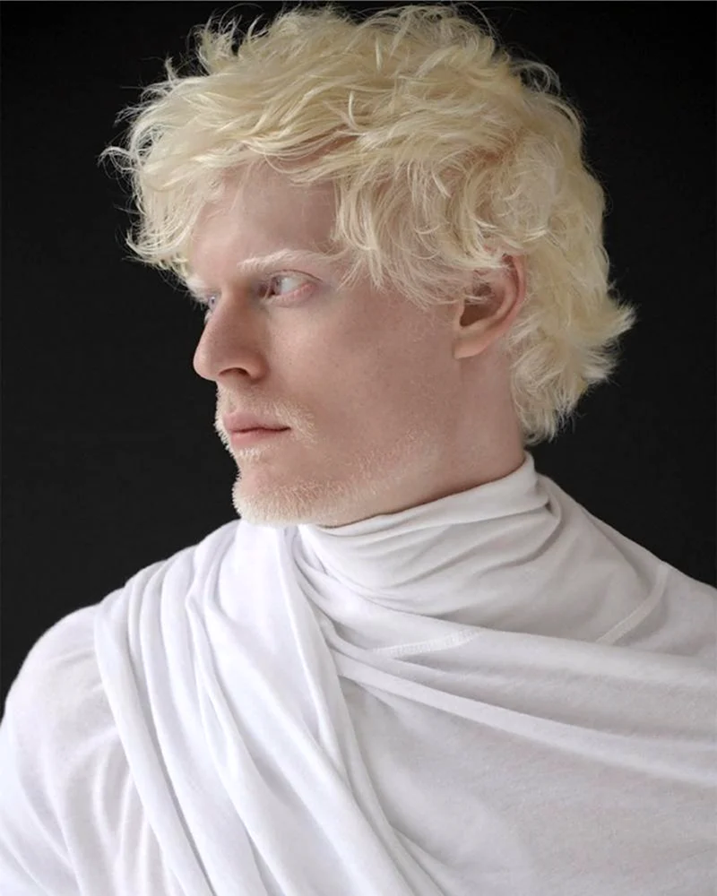Стивен Томпсон альбинос